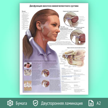 Плакат «Дисфункция височно-нижнечелюстного сустава» (ЗОЖ-33, 1 лист, А2)